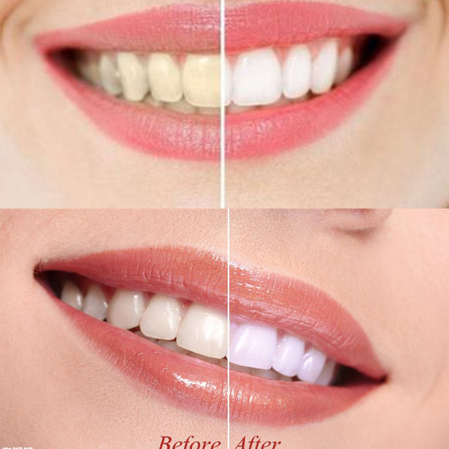 Bamboo Charcoal Teeth Tooth De - Teeth Whitening Kit 评论和价格