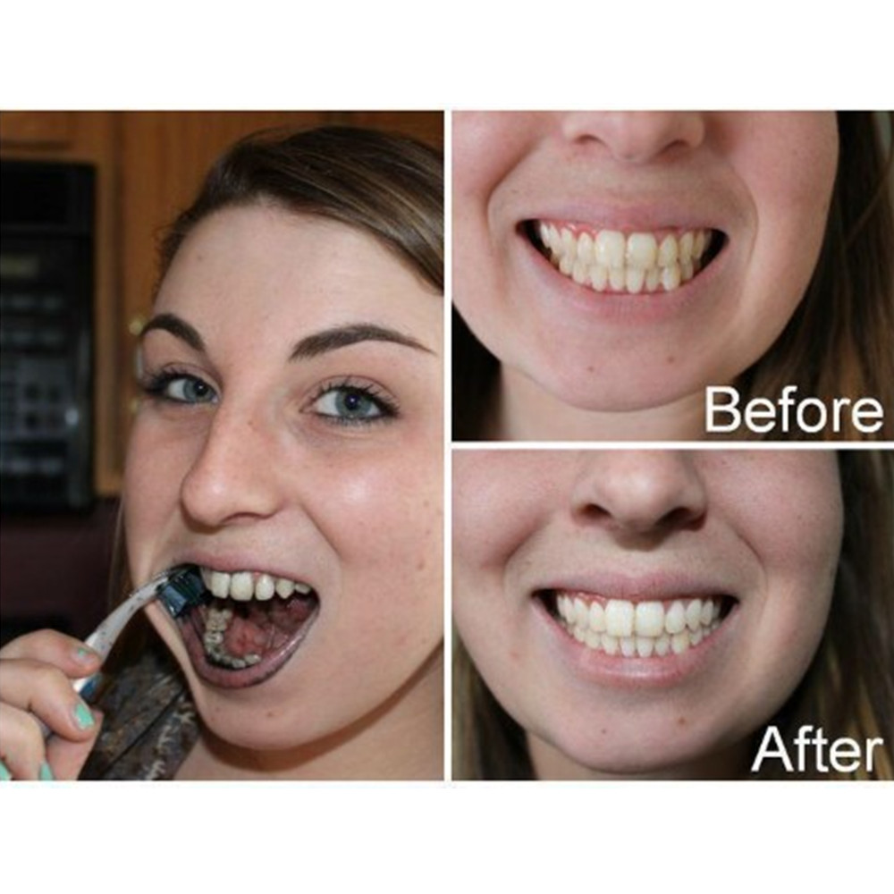 Bamboo Charcoal Teeth Tooth De - Teeth Whitening Kit 评论和价格