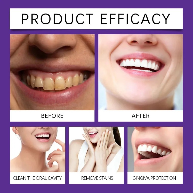 Purple Teeth Restoration Miner - Teeth Whitening Near Me 评论和价格